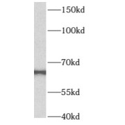 WB analysis of Jurkat cells, using B4GALNT2 antibody (1/1000 dilution).