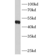 WB analysis of mouse skeletal muscle tissue, using B4GALT4 antibody (1/500 dilution).