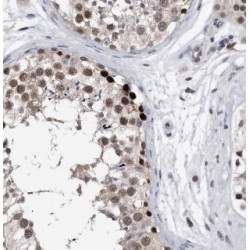 Brain And Acute Leukemia Cytoplasmic Protein (BAALC) Antibody
