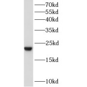 WB analysis of HEK-293 cells, using BAALC antibody (1/600 dilution).