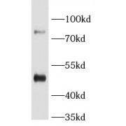 WB analysis of human liver tissue, using BAAT antibody (1/500 dilution).
