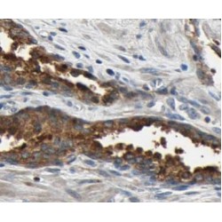 Bcl2-Associated Agonist Of Cell Death (BAD) Antibody