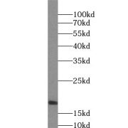 WB analysis of mouse heart tissue, using BAD antibody (1/1000 dilution).