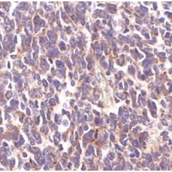 BRG1-Associated Factor 170 (BAF170) Antibody