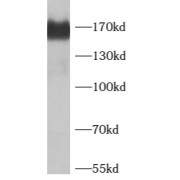 WB analysis of HeLa cells, using SMARCC2 antibody (1/500 dilution).