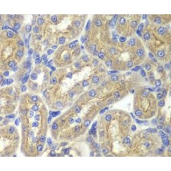 Brain-Specific Angiogenesis Inhibitor 1-Associated Protein 2 (BAIAP2) Antibody