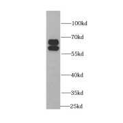 WB analysis of mouse brain tissue, using BAIAP2 antibody (1/1000 dilution).