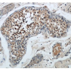 Bcl2 Associated X Protein (BAX) Antibody