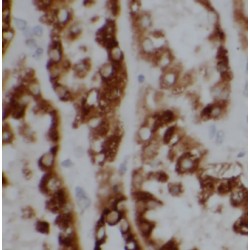 Bardet-Biedl Syndrome 5 Protein (BBS5) Antibody