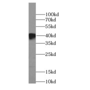 WB analysis of human brain tissue, using BBS5 antibody (1/1000 dilution).