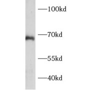 WB analysis of MCF-7 cells, using BCAS1 antibody (1/300 dilution).