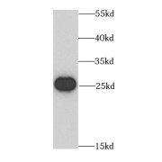 WB analysis of MCF7 cells, using BCAS2 antibody (1/1000 dilution).