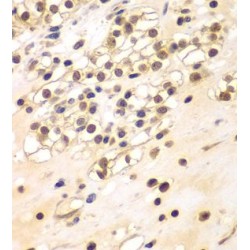 Breast Carcinoma Amplified Sequence 3 (BCAS3) Antibody