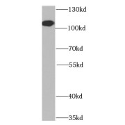 WB analysis of HeLa cells cells, using BCAS3 antibody (1/1000 dilution).