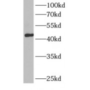WB analysis of human kidney tissue, using BCAT1 antibody (1/300 dilution).