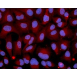 Cholinesterase (BCHE) Antibody