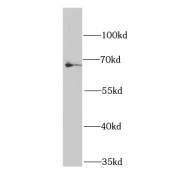 WB analysis of HeLa cells, using BCHE antibody (1/1000 dilution).