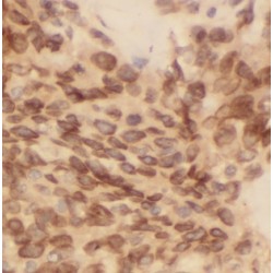 B-Cell Lymphoma/leukemia 10 (BCL10) Antibody