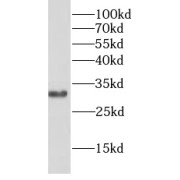 WB analysis of Jurkat cells, using BCL10 antibody (1/300 dilution).