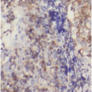 IHC-P analysis of human tonsillitis tissue, using BCL11A antibody (1/100 dilution).