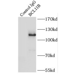 B-Cell Lymphoma/leukemia 11B (BCL11B) Antibody