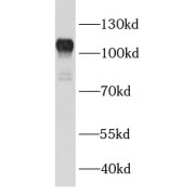 WB analysis of Jurkat cells, using BCL11B antibody (1/500 dilution).