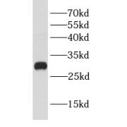 WB analysis of PC-3 cells, using BCL2L12 antibody (1/1000 dilution).