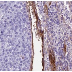 Bcl2 Like Protein 13 (BCL2L13) Antibody