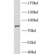 WB analysis of Jurkat cells, using BCL2L13 antibody (1/500 dilution).