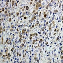 B-Cell CLL/Lymphoma 3 (BCL3) Antibody