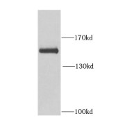 WB analysis of Y79 cells, using BCR antibody (1/1000 dilution).