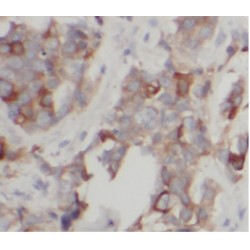 BCRP / ABCG2 Antibody