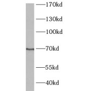 WB analysis of mouse brain tissue, using BCRP,ABCG2 antibody (1/300 dilution).