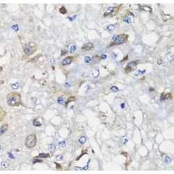 Mitochondrial Chaperone BCS1 (BCS1L) Antibody