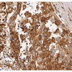 3-Hydroxybutyrate Dehydrogenase, Type 1 (BDH1) Antibody