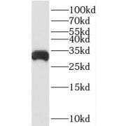 WB analysis of human liver tissue, using BDH1 antibody (1/500 dilution).