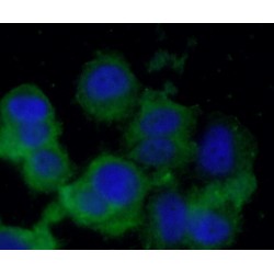 Brain-Derived Neurotrophic Factor (BDNF) Antibody