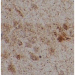 Brain-Derived Neurotrophic Factor (BDNF) Antibody