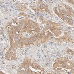 Brain-Enriched Guanylate Kinase-Associated Protein (BEGAIN) Antibody