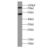 WB analysis of mouse colon tissue, using Bestrophin-3 antibody (1/800 dilution).