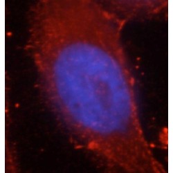 beta-Catenin (CTNNB1) Antibody