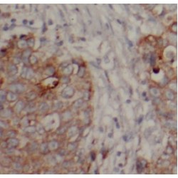 beta-Catenin (CTNNB1) Antibody