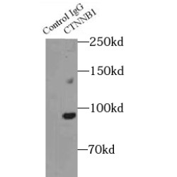 beta-Catenin (CTNNB1) Antibody