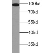 WB analysis of mouse lung tissue, using b-cat antibody (1/1000 dilution).