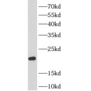 WB analysis of PC-3 cells, using BTC antibody (1/1000 dilution).