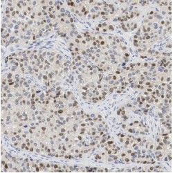 Brain-Expressed X-Linked Protein 2 (BEX2) Antibody