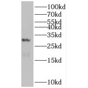 WB analysis of mouse liver tissue, using BHLHA15 antibody (1/300 dilution).