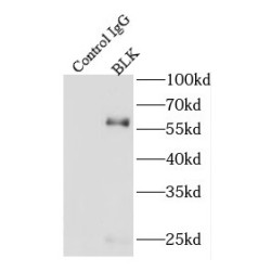 Tyrosine-Protein Kinase BLK (BLK) Antibody