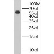 WB analysis of SH-SY5Y cells, using BLK antibody (1/500 dilution).