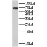 WB analysis of Raji cells, using BLNK antibody (1/1000 dilution).